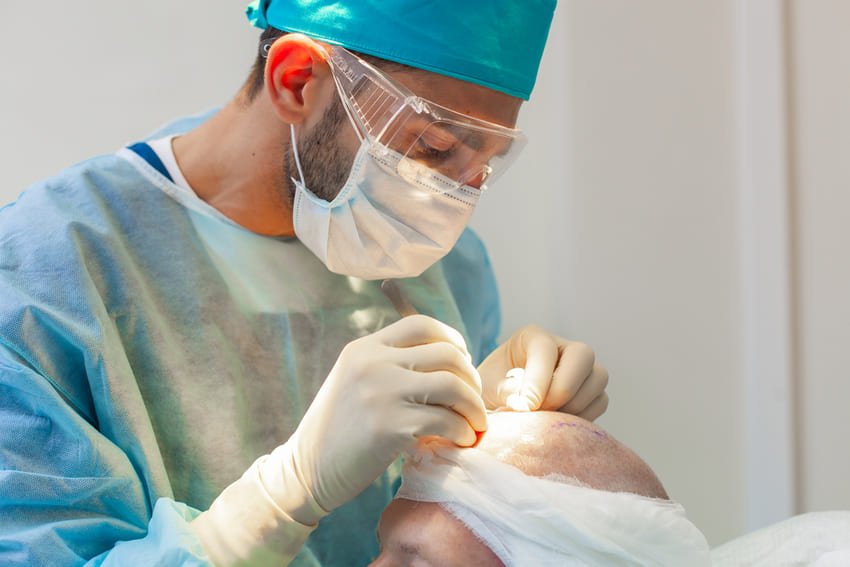 pregled kirurga tijekom transplantacije kose