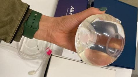 Želučani balon Allurion u ruci koordinatora